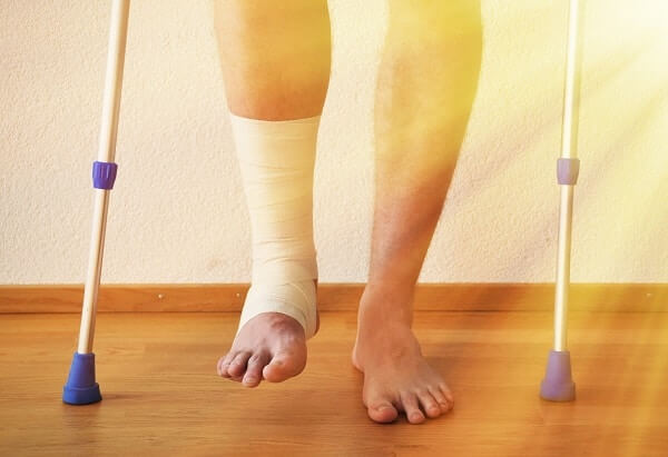 Do You Have to Report a Workplace Injury to Your Union?