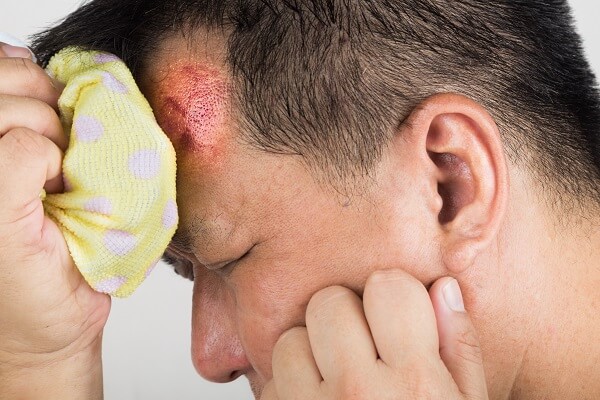 As a Loyal Longtime Employee, Should You Seek Workers’ Compensation?