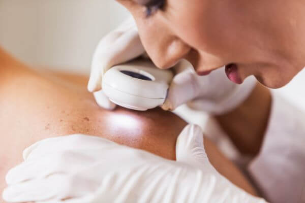 Skin Diseases and Minnesota Workers’ Compensation